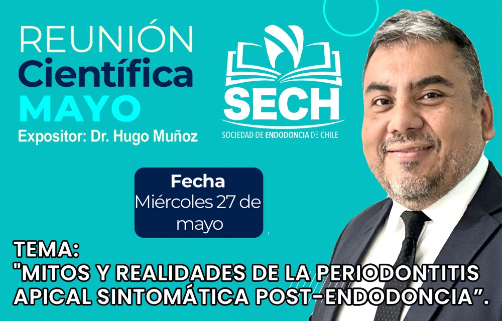Mitos y Realidades de la Periodontitis Apical Sintomática post-endodoncia
