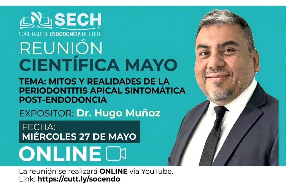 Mitos y Realidades de la Periodontitis Apical Sintomática post-endodoncia