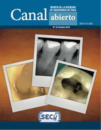 Revista Canal Abierto 34
